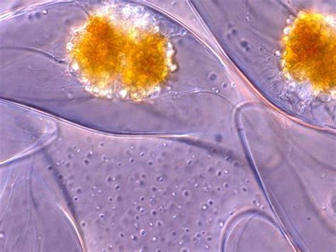  Kinetoplastida: Een Kleine Wezens Met een Grote Impact op de Microkosmos!