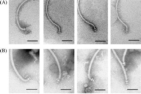 Monocercomonoides! Een microscopisch beestje dat zich door zijn omgeving voortbeweegt met behulp van flagella en zichzelf voedt met bacteriën die het toevallig tegenkomt?