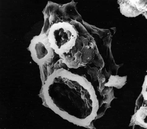 Naegleria fowleri: Een microscopisch roofdier met een enorme eetlust!