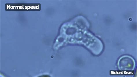 Naegleria fowleri: Een microscopisch roofdier met een enorme eetlust!