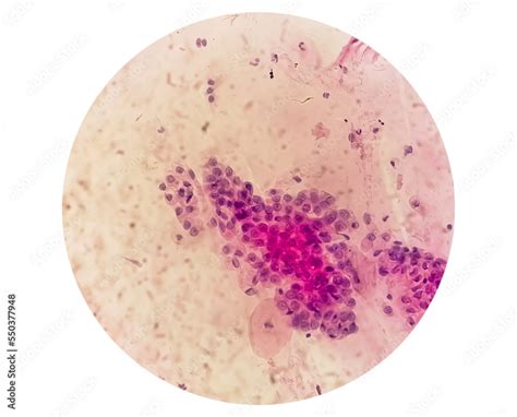 Trichomonas! Een microscopisch wezen met een onverwachte liefde voor zuurstof en een zwak voor vaginale infecties.