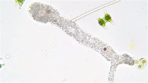 Echinostelium! Een fascinerende eencellige die zich voortbeweegt met pseudopodia en voedt via fagocytose.