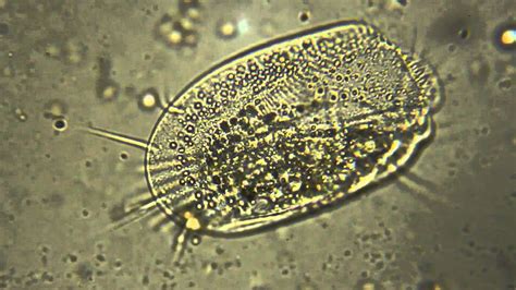  Euplotes! Een Microscopische Wonderwereld Vol Onverwachte Bewegingen en Geestige Voedingstrategieën