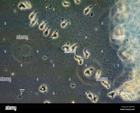  Ovulomyxa: Een Amoebe die zich Voedt met Bacteriën en Danste door het Water!